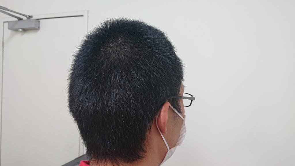 ボウズ、バリカン、リスク オブ アイス。